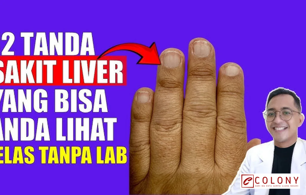 ciri ciri penyakit liver