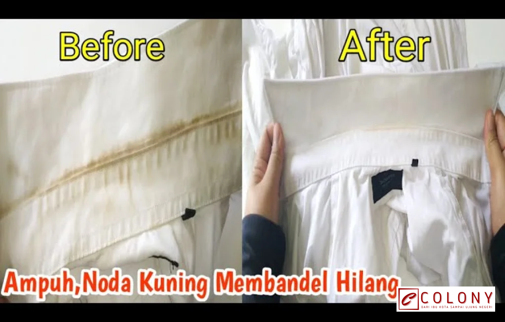 flek kuning baju putih